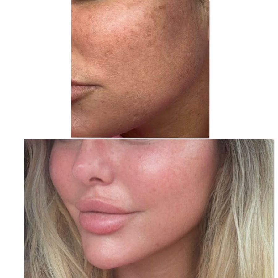 Client skin transformation result at Golden Oasis Tanning Rochdale