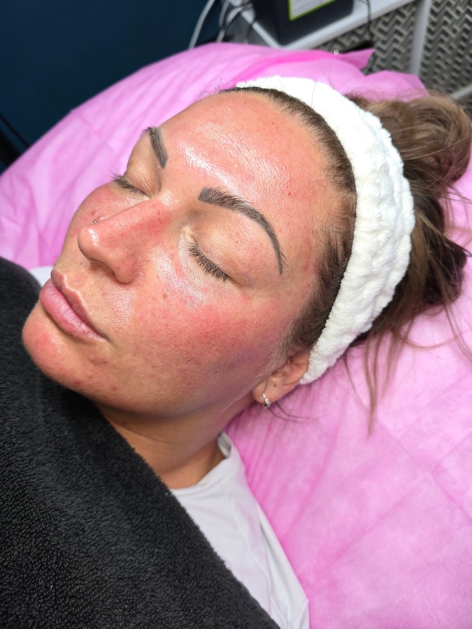 Client facial treatment at Golden Oasis Milnrow