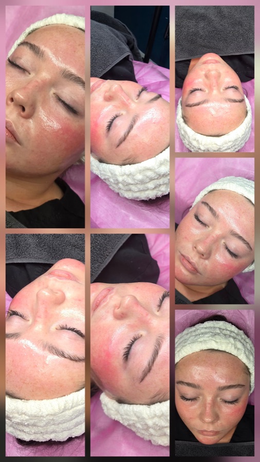 Client treatment results at Golden Oasis Rochdale